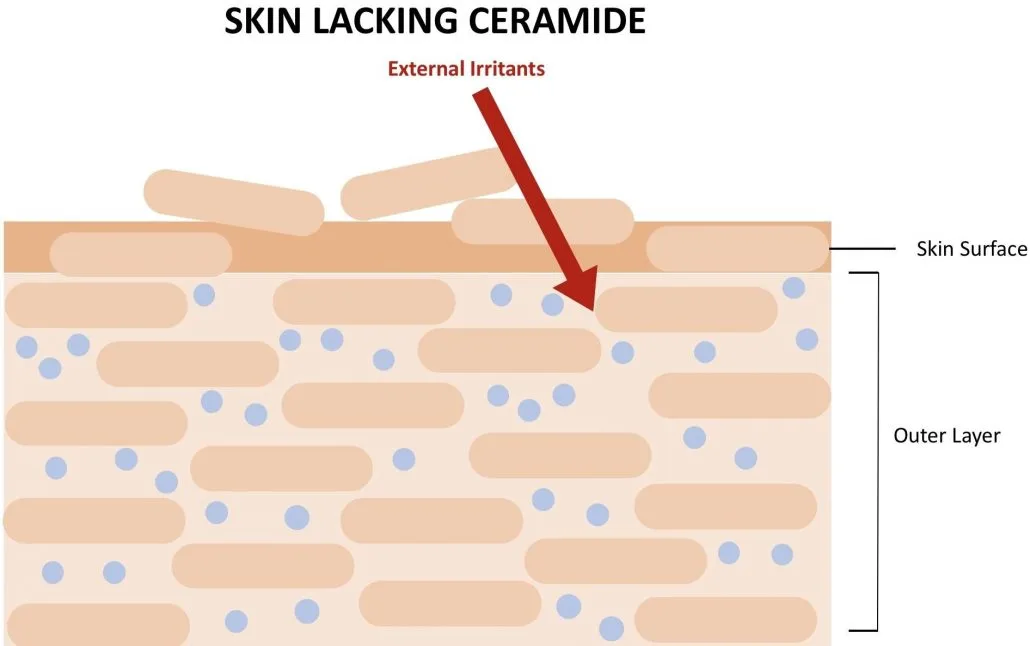 External Irritants Penetrate Skin Lacking Ceramides