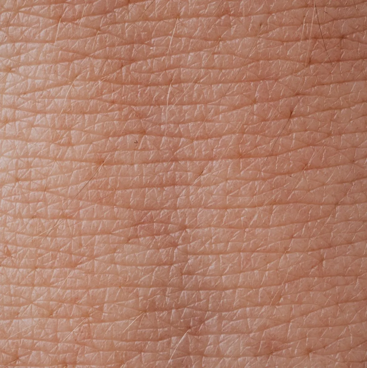 causes of dry skin