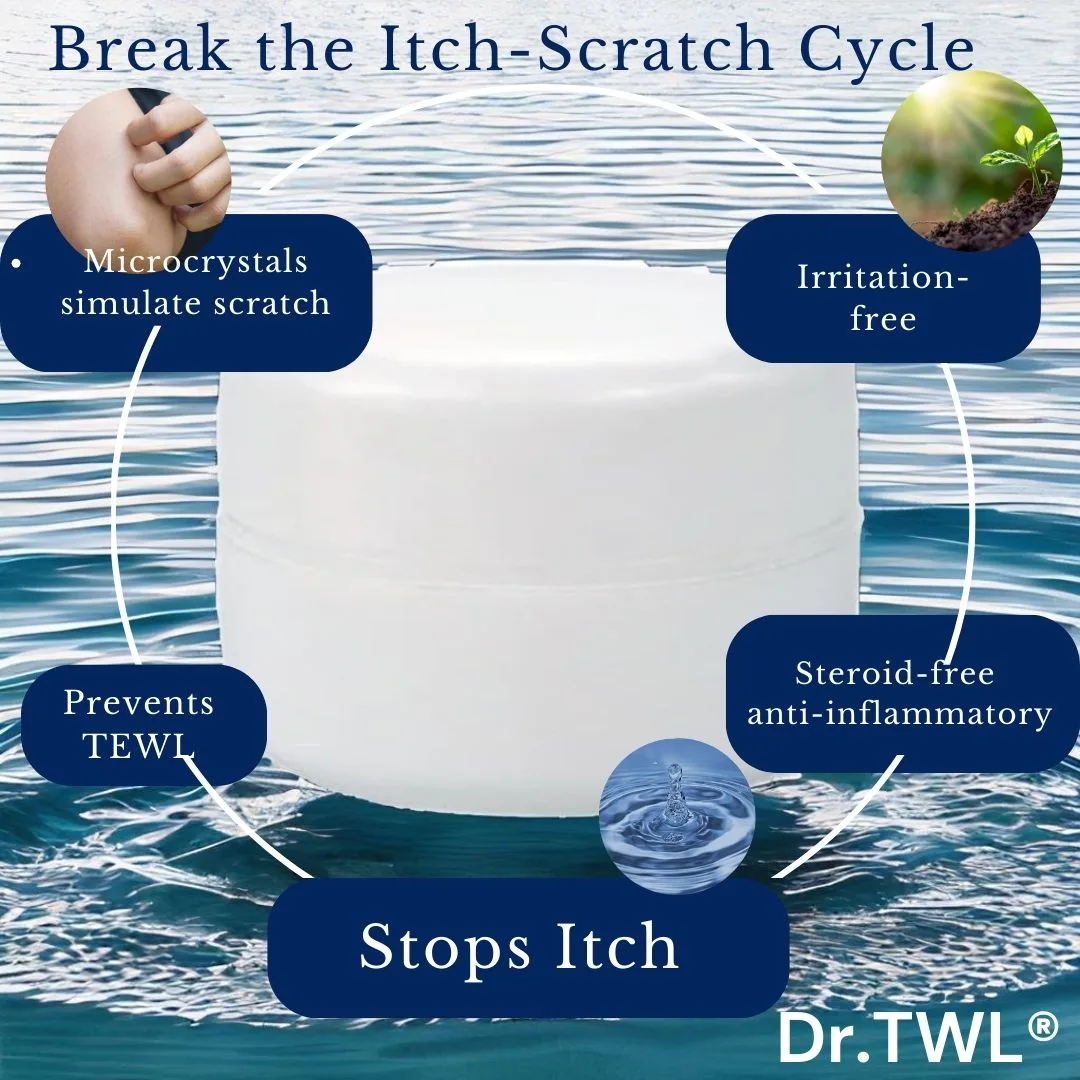 Eczema Itch Relief Cream Break the Itch Scratch Cycle